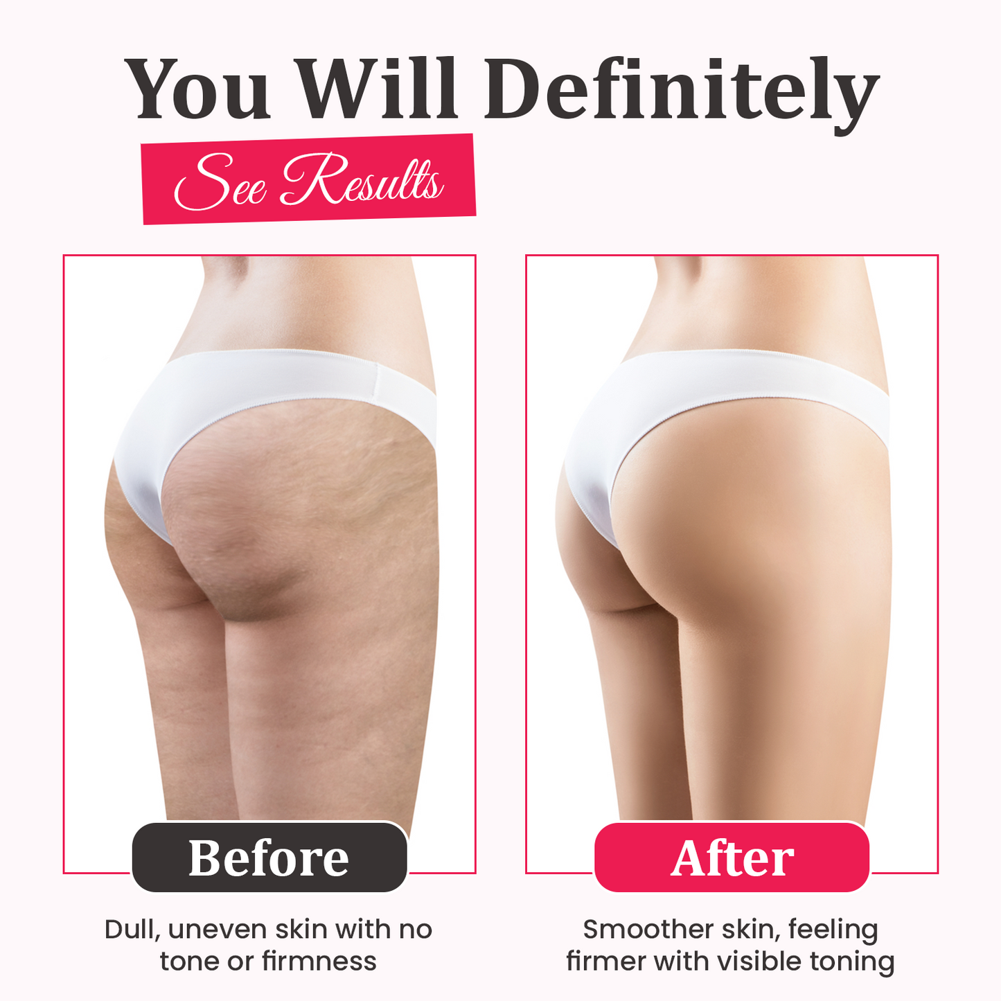 Sexy Legs Kit - Anti Cellulite Massage Oil, Firming Cream & Body Scrubber Massager 3-in-1 BUNDLE