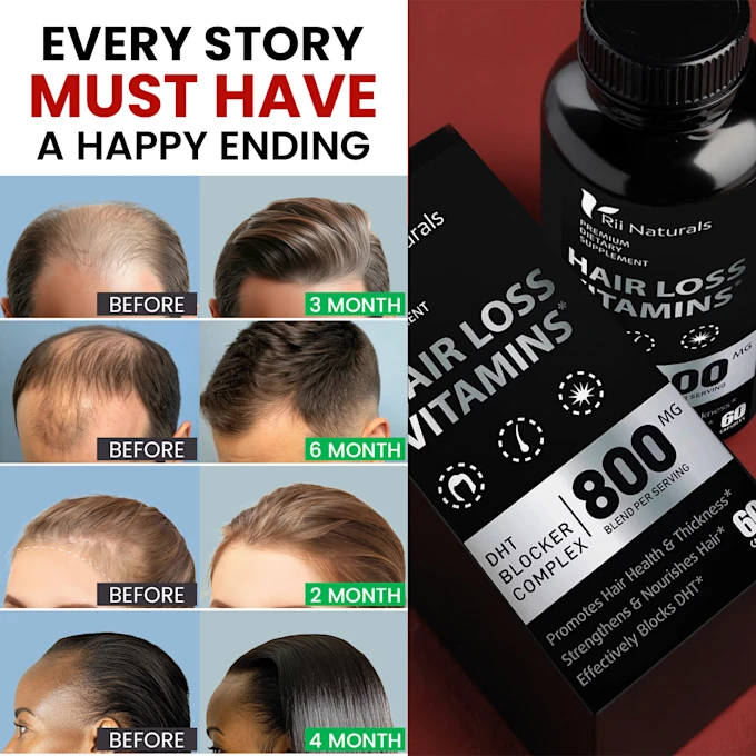 DHT Blocker Hair Fast Growth Pills with Saw Palmetto To Prevent Hair Loss