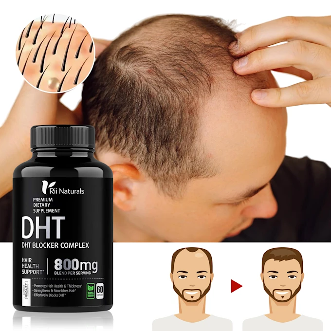 DHT Blocker Hair Fast Growth Pills with Saw Palmetto To Prevent Hair Loss