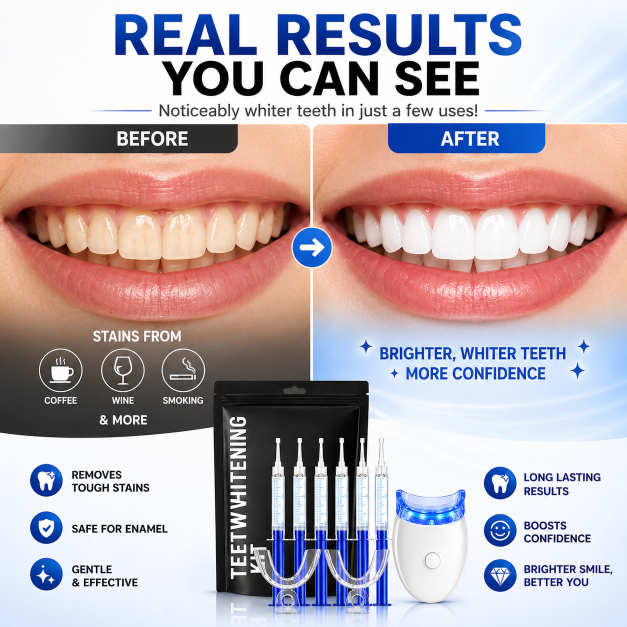 Teeth Whitening Gel Kit 5X Strong Tooth Bleaching Kit with LED Light Tray